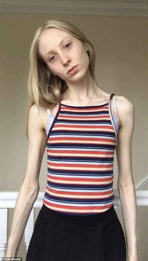 anorexic xxx|ANOREXIC PORN